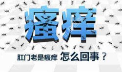 肛門瘙癢治不好嗎？先檢查病因就好辦！